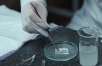 ابتكار ضمادة ذكية متعددة الوظائف لتسريع شفاء الجروح ومكافحة العدوى