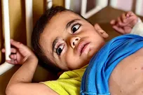 بحران انسانی در غزه؛ شیوع هولناک بیماری‌های پوستی میان کودکان در سایه قحطی و جنگ