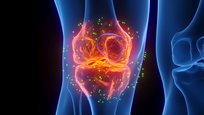 New Iranian stem cell therapy receives regulatory approval