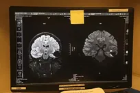 خواب موجب دفع سموم مغز نمی‌شود