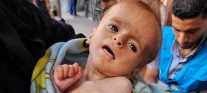 محاصره بی&zwnj;رحمانه غزه حکایت از مرگ کودکان و سالمندان بر اثر گرسنگی و سوءتغذیه دارد