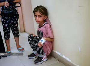 کودکانی که در غزه بر اثر گرسنگی تبدیل به اسکلت شده&zwnj;اند