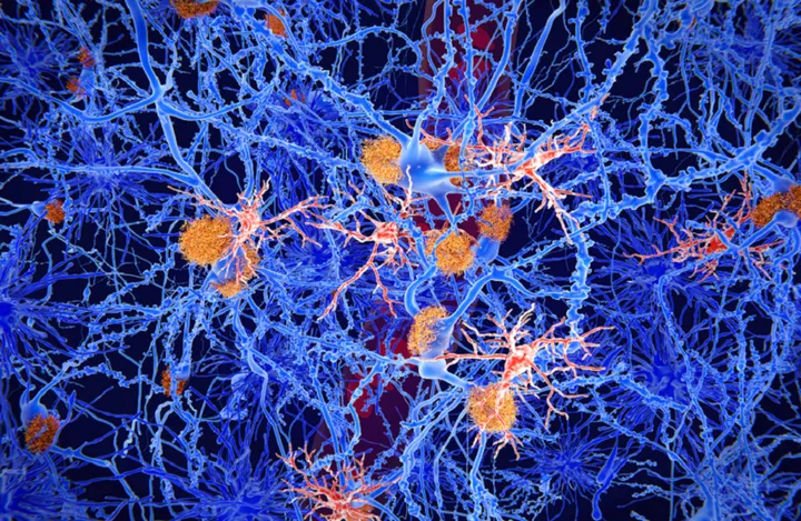 علاج ثوري للصرع يستهدف شيخوخة الخلايا ويعزّز الذاكرة