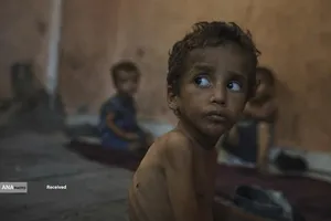 کودکانی که در غزه بر اثر گرسنگی تبدیل به اسکلت شده&zwnj;اند