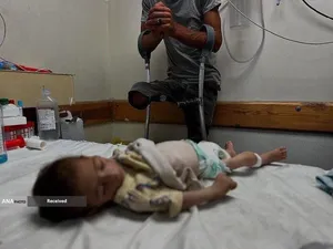 گرسنگی فاجعه بار در غزه