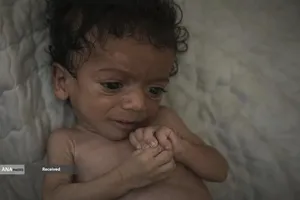 کودکان غزه در صف مرگ بدلیل سوء&zwnj;تغذیه، گرسنگی، و کمبود کمک&zwnj;ها و خدمات حیاتی