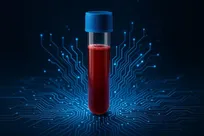 هوش مصنوعی پیام‌های پنهان خون را می‌شنود