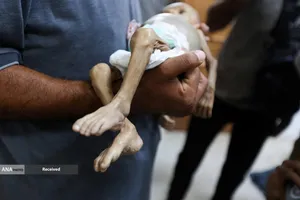 کودکان غزه در صف مرگ بدلیل سوء&zwnj;تغذیه، گرسنگی، و کمبود کمک&zwnj;ها و خدمات حیاتی