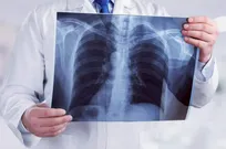 منبع نور اشعه ایکس چیست؟