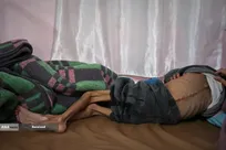 محاصره غذایی غزه