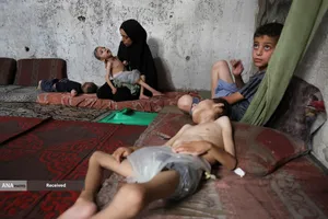 کودکانی که در غزه بر اثر گرسنگی تبدیل به اسکلت شده&zwnj;اند