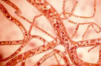 New technique enables precise growth of tiny blood vessels in the lab