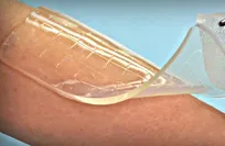Fish collagen hydro gel shows promise in accelerating wound healing