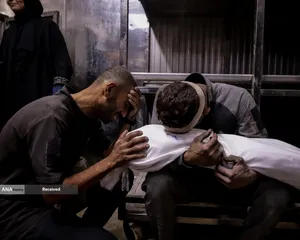 کودکانی که در غزه بر اثر گرسنگی تبدیل به اسکلت شده&zwnj;اند