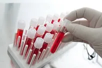 اهدای خون برای اولین بار در گروه سنی زیر ۲۵ سال اهمیت راهبردی دارد
