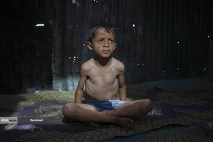 شدیدترین محاصره انسانی عصر حاضر در نوازه