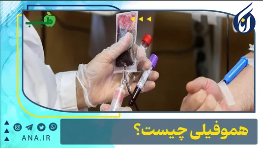 هموفیلی چیست؟