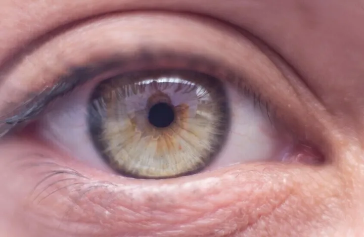 International study links air pollution to serious eye diseases