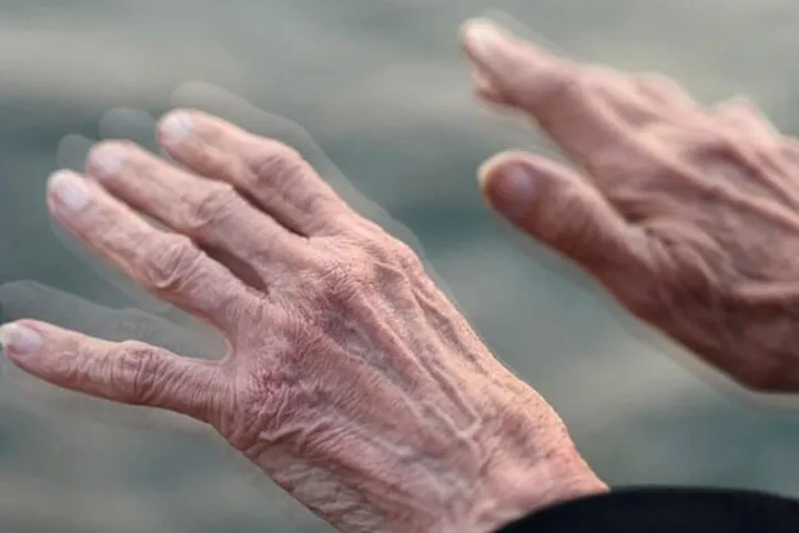 Study identifies unexpected viral link to Parkinson’s disease risk