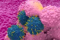 Molecule linked to aggressive breast cancer identified