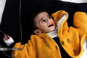 کودکان غزه در صف مرگ بدلیل سوء&zwnj;تغذیه، گرسنگی، و کمبود کمک&zwnj;ها و خدمات حیاتی