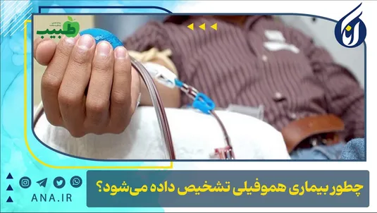 چطور بیماری هموفیلی تشخیص داده می‌شود؟