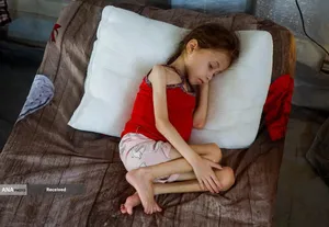 کودکانی که در غزه بر اثر گرسنگی تبدیل به اسکلت شده&zwnj;اند