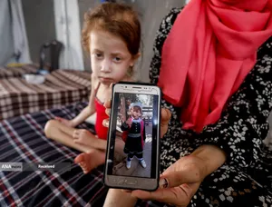 کودکانی که در غزه بر اثر گرسنگی تبدیل به اسکلت شده&zwnj;اند