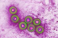 استراتيجية علاجية مبتكرة تفتح آفاقاً جديدة أمام سرطانات نادرة في الدم