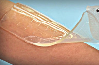 Fish collagen hydro gel shows promise in accelerating wound healing