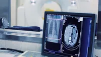 سکوی هوشمند AIMEDIC؛ دستاورد فناورانه ایرانی در تحلیل تصاویر پزشکی