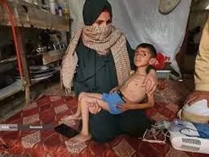 گرسنگی فاجعه بار در غزه