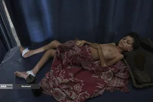 کودکان غزه در صف مرگ بدلیل سوء&zwnj;تغذیه، گرسنگی، و کمبود کمک&zwnj;ها و خدمات حیاتی