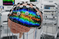 Iranian company unveils homegrown brain-mapping system