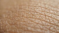 This Common Fungus Found on Human Skin Wipes Out Deadly Superbug